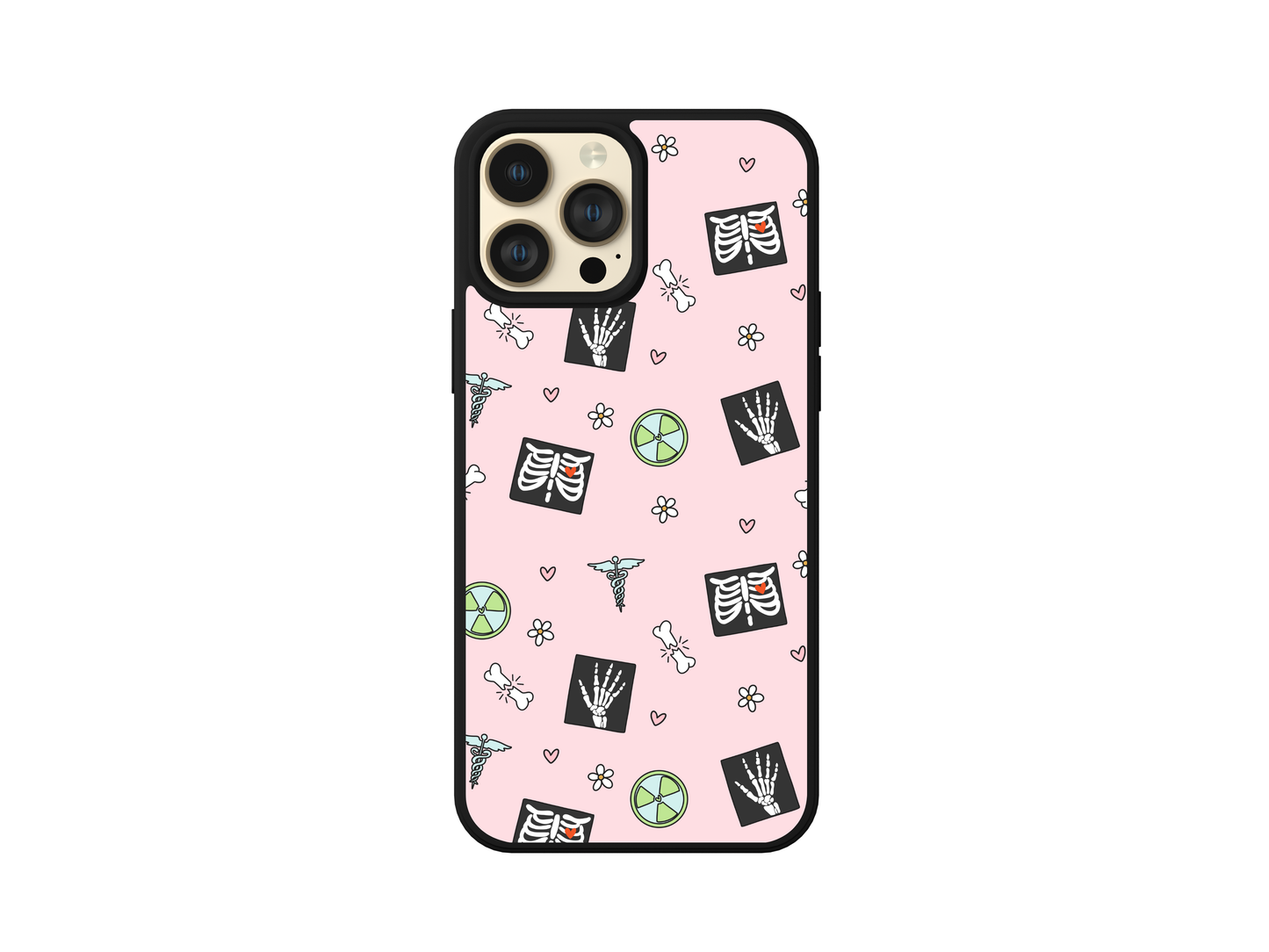 Phone Case - X-ray tech